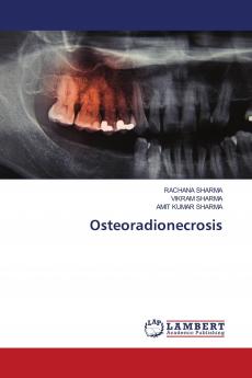 Osteoradionecrosis