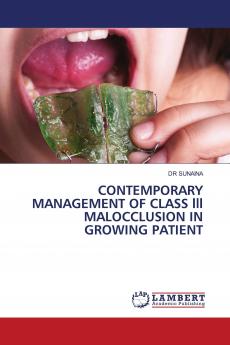 CONTEMPORARY MANAGEMENT OF CLASS lll MALOCCLUSION IN GROWING PATIENT