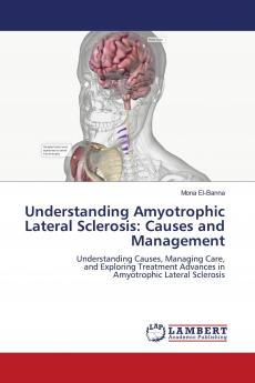 Understanding Amyotrophic Lateral Sclerosis: Causes and Management