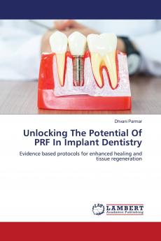 Unlocking The Potential Of PRF In Implant Dentistry