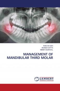 MANAGEMENT OF MANDIBULAR THIRD MOLAR