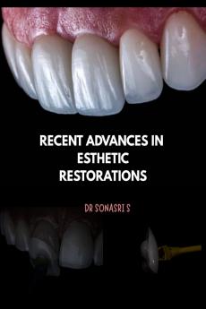 RECENT ADVANCES IN ESTHETIC RESTORATIONS: Recent advances in direct and indirect restorations