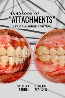 HANDBOOK OF "ATTACHMENTS": ART OF ALIGNER CONTROL
