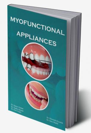 MYOFUNCTIONAL APPLIANCES