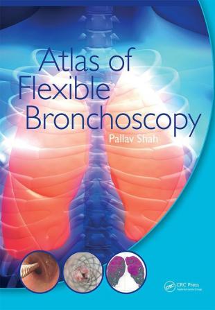 Atlas of Flexible Bronchoscopy