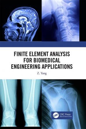 Finite Element Analysis for Biomedical Engineering Applications