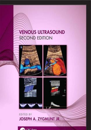 Venous Ultrasound