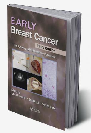 Early Breast Cancer