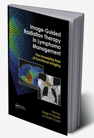 Image-Guided Radiation Therapy in Lymphoma Management