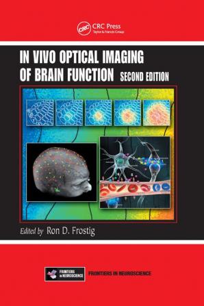 In Vivo Optical Imaging of Brain Function