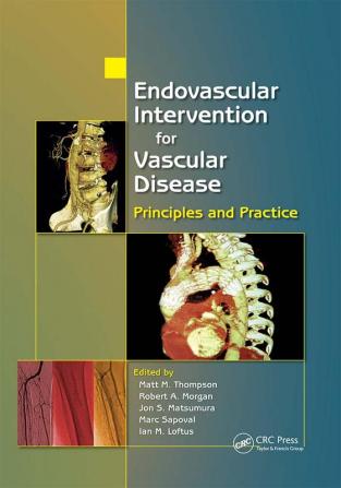 Endovascular Intervention for Vascular Disease