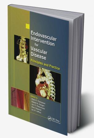 Endovascular Intervention for Vascular Disease