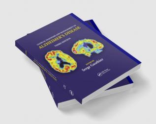 Clinical Diagnosis and Management of Alzheimer's Disease