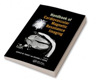 Handbook of Cardiovascular Magnetic Resonance Imaging