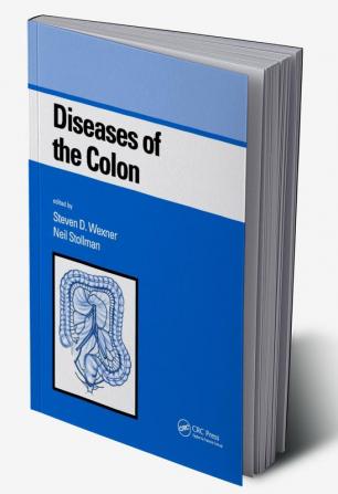 Diseases of the Colon