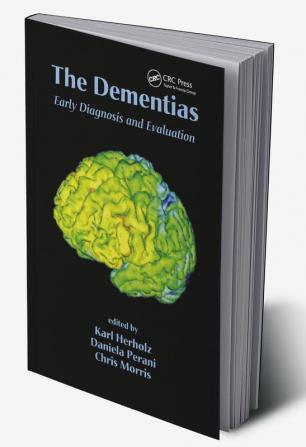 Dementias