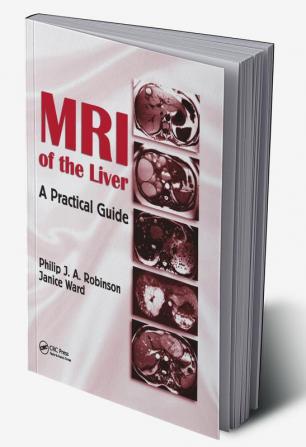 MRI of the Liver