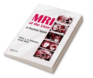 MRI of the Liver