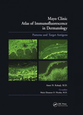 Mayo Clinic Atlas of Immunofluorescence in Dermatology