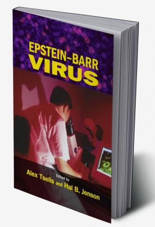 Epstein-Barr Virus