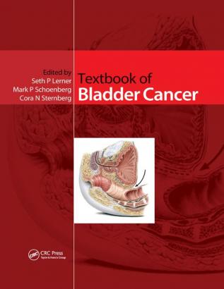 Textbook of Bladder Cancer