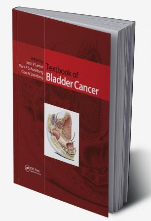 Textbook of Bladder Cancer