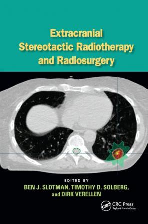 Extracranial Stereotactic Radiotherapy and Radiosurgery