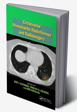 Extracranial Stereotactic Radiotherapy and Radiosurgery