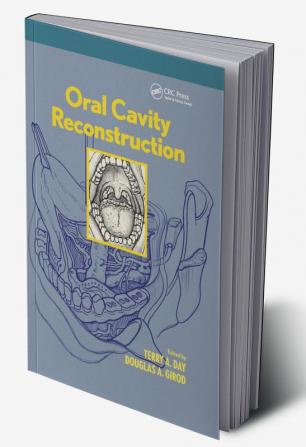 Oral Cavity Reconstruction