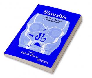 Sinusitis