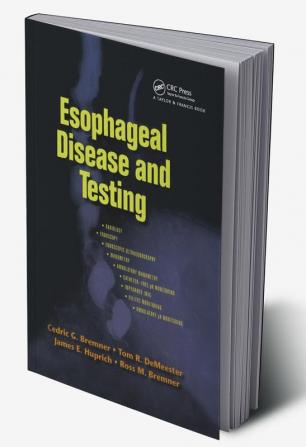 Esophageal Disease and Testing