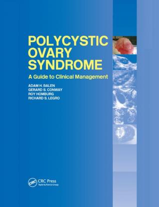 Polycystic Ovary Syndrome