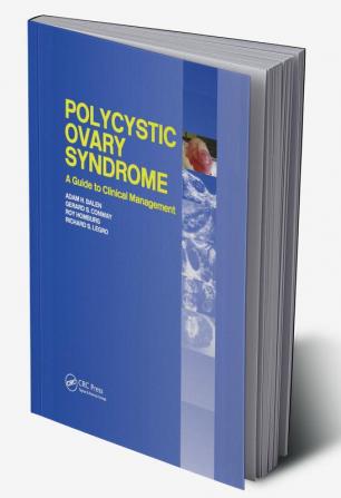 Polycystic Ovary Syndrome