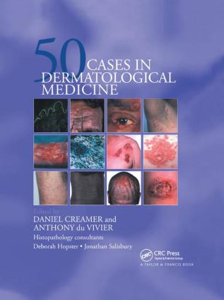 Fifty Dermatological Cases