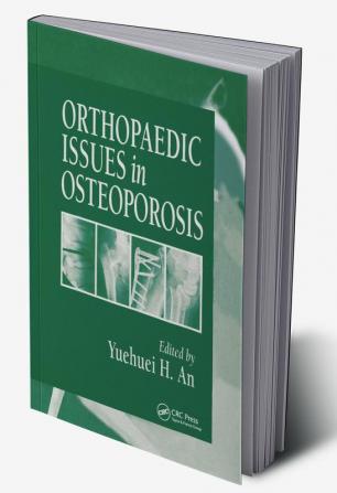 Orthopaedic Issues in Osteoporosis