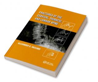 Fractures of the Cervical Thoracic and Lumbar Spine