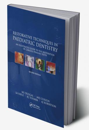 Restorative Techniques in Paediatric Dentistry