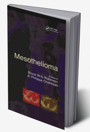 Mesothelioma