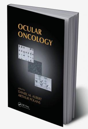 Ocular Oncology