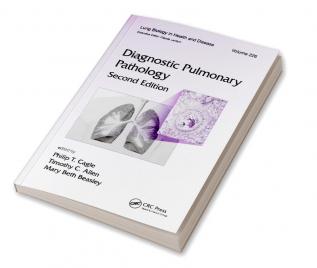 Diagnostic Pulmonary Pathology