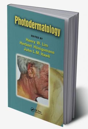 Photodermatology