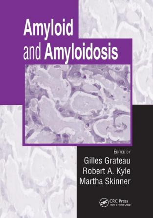 Amyloid and Amyloidosis