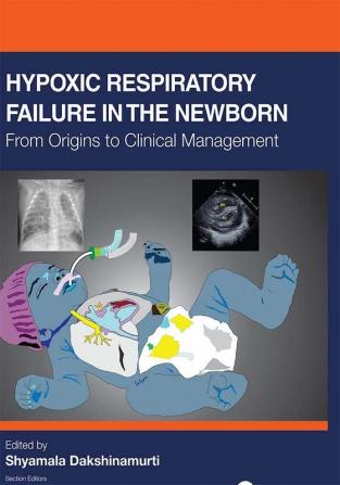 Hypoxic Respiratory Failure in the Newborn