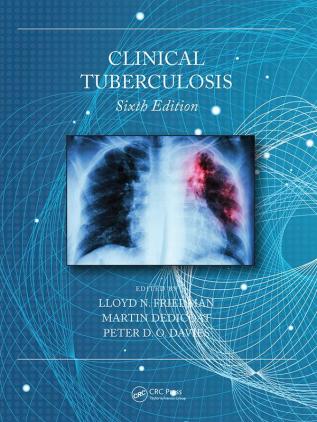 Clinical Tuberculosis