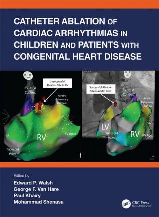 Catheter Ablation of Cardiac Arrhythmias in Children and Patients with Congenital Heart Disease