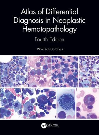 Atlas of Differential Diagnosis in Neoplastic Hematopathology