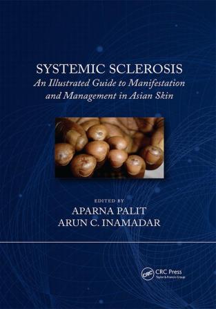 Systemic Sclerosis