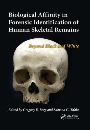 Biological Affinity in Forensic Identification of Human Skeletal