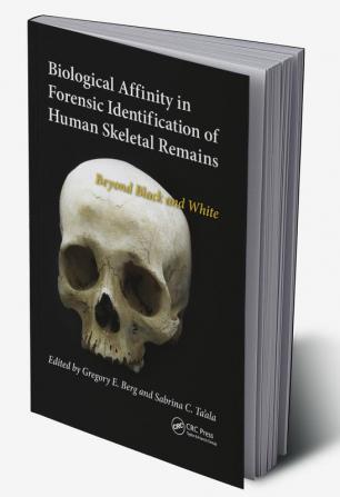 Biological Affinity in Forensic Identification of Human Skeletal