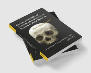 Biological Affinity in Forensic Identification of Human Skeletal